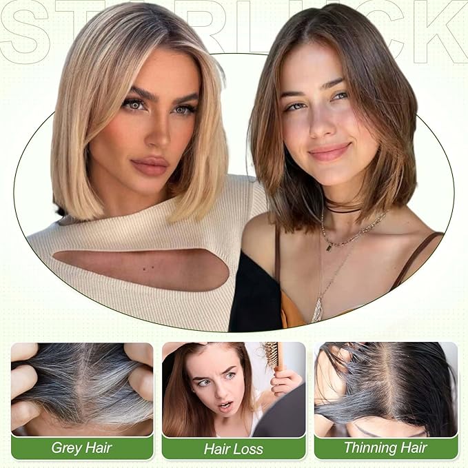 starluck Human Hair Toppers for Women with Thinning Hair, 10 Inch Real Hair Topper, 5.5x3.5 Inch Silk-like Skin Base Hairpiece, With Bangs (Brown)