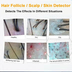 5 in 1 Scalp Skin Hair Follicle Scalp Detector, Multifunction Hair Care Machine Hair Analyzer, 70X 200X Lens Scalp Health Detection for Home Salon Beauty Salon