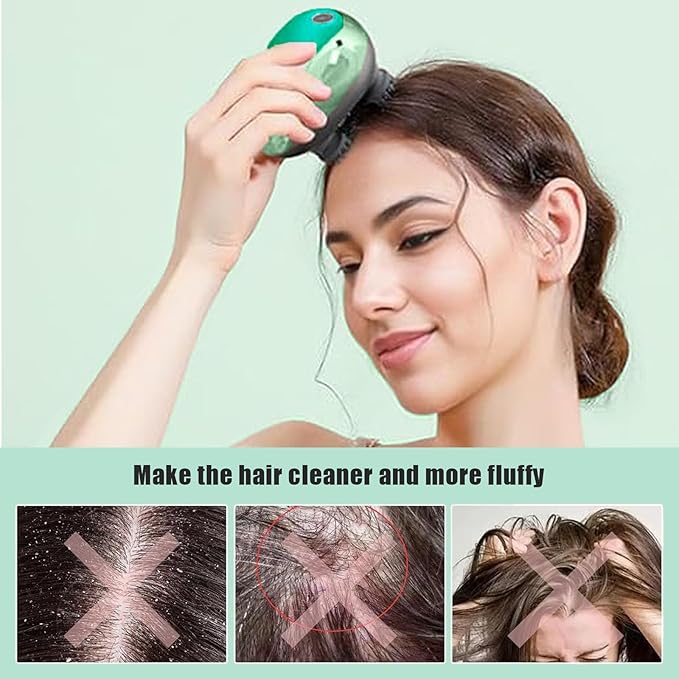 Electric Scalp Massager, Head Massage Scalp with 4 Removable Massage Claws, Rechargeable,Promotes Hair Growth, Relieves Stress, Waterproof, Portable Handheld Head Massager,Gift