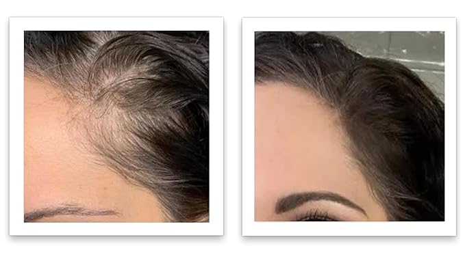 Caboki Root Touch Up Powder: Fill in Thinning Hair, Hairline & Edges, Cover Bald Spots & Gray Hair - TALC-Free, Volumizing Hair Fiber for Men & Women in Salt & Pepper and Dark Shades