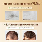 Hair Growth Serum Scalp Treatment: Scalp Serum with Rosemary, Multi-Peptide & Caffeine for Anti Hair Loss and Thinning - Thickening and Density for Women & Men