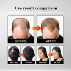5% Minoxidil Hair Liquid for Men & Women, 2 x 3ml, with Ginseng & Ginger Root Extract - Hair Growth Supporting Treatment for Thinning Hair, Scalp Care Serum to Help Reduce Hair Loss Appearance