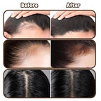 Root Touch Up Powder Hair Color Dark Brown, Root Cover Up Hair Powder for Women Scalp Concealer, HairlinePowder for Women GrayHair
