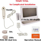 Professional Scalp Camera with 11-Inch HD Screen - High-Definition Hair & Scalp Analysis Device for Salons and Spas, Easy to Use, Ideal for Scalp Care & Client Consultations