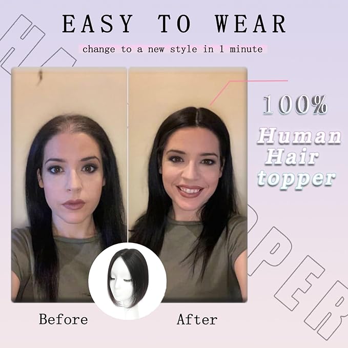 Hair Toppers for Women with Thinning Hair Toppers Hair Pieces for Women 10 Inch Hair Topper No Bangs Hairline Topper for Women Wiglets Hairpieces for Thinning Hair(Natural Black)