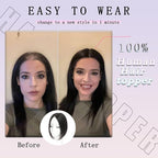 Hair Toppers for Women with Thinning Hair Toppers Hair Pieces for Women 10 Inch Hair Topper No Bangs Hairline Topper for Women Wiglets Hairpieces for Thinning Hair(Natural Black)