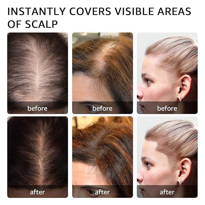 Root Touch Up Hair Color Powder For Concealing Hair Loss and Thinning, Gray Hair Shadow Powder Root Cover Up Hairline Powder For Women Men Eyebrows, Beard Line (Dark Blonde, 0.14 Ounce)