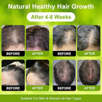 Dr. Sebi 100% RAW Batana Oil – Unrefined & Natural Batana Oil for Hair Growth, Boosts Thickness & Shine, Repairs Damage, Reduces Hair Loss, Fights Frizz & Split Ends For Men & Women 4.23 Fl Oz