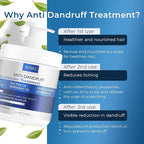 Anti Dandruff Deep Conditioner with Tea Tree Oil & Salicylic Acid | Anti-Fungal Relief | Dandruff Treatment For Itchy Scalp and Folliculitis | Scalp Treatment Which Promotes Healthy Hair Growth