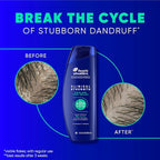 Head & Shoulders Anti-Dandruff Shampoo, Clinical Strength Intensive Itch Relief Twin Pack, 1% Selenium Sulfide, Seborrheic Dermatitis Relief, Itch Relief, 13.5 fl oz Each