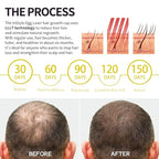 Instyle Egg 280 Cap for Hair Regrowth, Low Level Laser Therapy System for Hair Loss and Regrow Thinning Hair for Men/Women