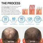 Instyle Egg Laser Cap 272 for Hair Growth, Hair Regrowth System for Men/Women, Scalp Treatment to Stop Hair Loss and Regrows Thinning Hair, laser hair regrowth