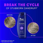 Head & Shoulders Anti-Dandruff Shampoo, Clinical Strength Advanced Oil Control Twin Pack, 1% Selenium Sulfide, Seborrheic Dermatitis Relief, Oily Scalp, 13.5 fl oz Each