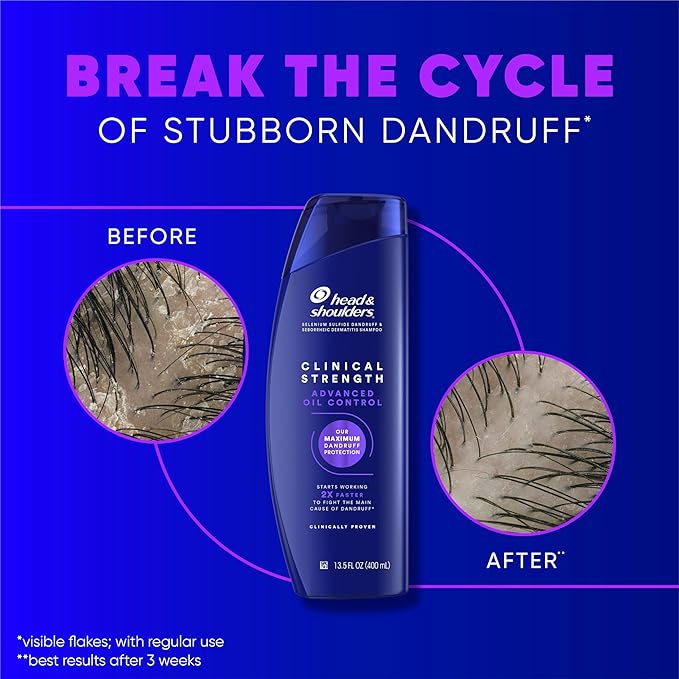 Head & Shoulders Anti-Dandruff Shampoo, Clinical Strength Advanced Oil Control Twin Pack, 1% Selenium Sulfide, Seborrheic Dermatitis Relief, Oily Scalp, 13.5 fl oz Each