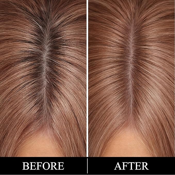 Root Touch Up Hair Color – 3 Color Blendable Hairline Powder for Gray Coverage, Root Cover Up & Thinning Edges – 48H Sweat Resistant, Natural Finish for Women & Men – Dark Brown