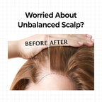 KUNDAL Hair Loss Serum Roll-on 10X Caffeine for Stronger Roots Cooling Menthol & Botanical Hair Regrowth Longevity Korean Scalp Wellness Care For Thinning Hair 0.33 fl oz, Stocking Stuffers