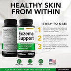 Greenford Eczema Treatment & Support for Natural Relief - Made in USA - Skin Vitamins & Herbals for Eczema, Acne, Psoriasis, Rosacea Treatment with Zinc, Niacinamide & Probiotics - 60 caps