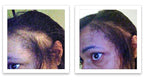 Hair Powder For Thinning Hair. Makes Thin Hair Look 10X Fuller, Covers Bald Spot Instantly. All-Natural Hair Building Fiber. Trial Size (10-Day Supply). Black