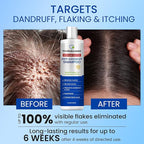 Anti-Dandruff Shampoo with Selenium Sulfide – Medicated Anti-Fungal Formula for Seborrheic Dermatitis & Folliculitis – Itchy, Flaky & Oily Scalp Relief – Menthol & Lavender Oil