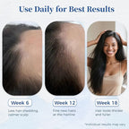 Hair Growth Serum Roll On with Rosemary，Helps Support Thicker, Fuller Hair Appearance，Clean, Non-Greasy Hair Loss Support for Men & Women，Saw Palmetto，0.84 Fl Oz (Pack of 1)