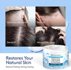Roycederm Seborrheic Dermatitis Cream, Scalp Treatment for Psoriasis, Folliculitis, Dry Scalp, Dandruff, Anti-Itch Cream for Soothing Relief - 2 Pack