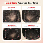 CAYAMA Red Light Therapy Cap, Laser Hair Growth Cap Red Light Therapy for Hair Growth – 528-LEDs