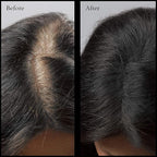 Root Touch Up Powder - 11 True-to-Nature Hairline Concealer Shades - No Fragrance, Talc or Parabens - Hair Cover by NuBeauti (Without Brush, Black)