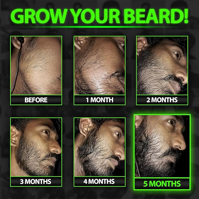 Beard Growth Serum - GROW Maximum XXL Beard Growth Oil for Men -Thickens & Fills Patches - Facial Hair & Scalp Treatment - Beard & Hair Thickening Conditioner & Enhancer