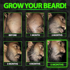 Biotin Beard Balm + XXL Beard Growth Serum + 620,000mcg Beard Growth Vitamins – Beard Growth Kit for Men with Mustache Wax, Collagen, MSM & Castor Oil – Fills Patches, Thickens & Styles