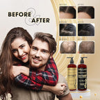 DHT Pro Shampoo and Conditioner - Advanced Formula with Procapil and Capixyl, DHT Blockers, Made In USA, Hair Loss Solution for Men and Women, Stimulates Follicles, SupportsThinning Hair