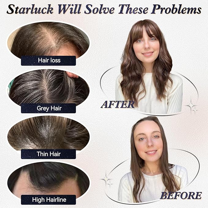 starluck Hair Toppers for Women Real Human Hair With Bangs, 100% Remy HumanHair Toppers for Women Hand-woven with Thinning,Cover Gray Roots,Adds Volume,Ombre Light Blonde