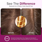 Minoxidil for Women 5% Foam - Helps Restore Top of Scalp Hair Loss and Support Hair Growth for Women, Regrowth with Unscented Topical Treatment for Thinning Hair (5% Foam 8-Month Supply)