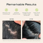 Jupiter Scalp Exfoliator - Scalp Massager Tool for Wet & Dry Hair - Ergonomic Detangler Brush - Dandruff Comb & Scrub to Remove Dandruff & Buildup and Support Circulation - Black/White