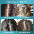 Scalp Scrub, Biotin 2-in-1 Scalp Exfoliator Scrub Clarifying Detox Shampoo with 3% Salicylic Acid & Tea Tree for Dandruff, Build Up, Itchy Scalp, Oily Hair & Dry Scalp Treatment with Scalp Massager