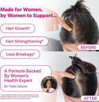 Pink Stork Postpartum Hair Loss Gummies | Biotin, Pantothenic Acid, Vitamin E, B6, B12 | Postnatal Hair Growth + Regrowth Support | Breastfeeding-Friendly | Postpartum Essentials | 60 Gummies