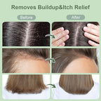Scalp Scrub, Rosemary & Mint Oil & Biotin Scalp Exfoliator Scrub Shampoo with Silicone Cleansing Massager, Hair Treatment for Itchy Scalp, Dandruff & Buildup Removal & Thick and Strong Hair Growth