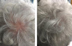 Hair Thickening Fibers. Cover Bald Spot and Thinning Hair Instantly. Make Thin Hair Look 10X Fuller. All-Natural Hair Building Fiber. Trial Size (10-Day Supply). Silver/White