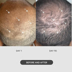 DS Labs StimuROLLER Hair Micro-Needle Hair Stimulation System 0.25mm, Packaging May Vary