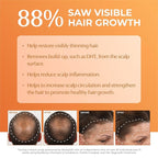 BosleyMD BosRevive Color-Safe Hair Care Kit for Thinning Hair, Starter Size (30 Days) – Shampoo, Conditioner & Thickening Treatment with Biotin, Panthenol & Botanical Extracts