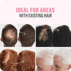 BOLDIFY Hair Fibers (56g) - Fill In Thinning and Fine Hair for an Instantly Fuller, Thicker Look - 14 Shades for Women & Men - Dark Brown