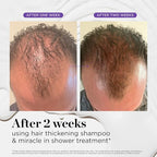 Dr. Groot Miracle in Shower Moisturizing Treatment for Hair Loss, Korean Hair Care Rinse, Rosemary Oil for Smooth, Healthier-Looking Hair in 5 Seconds, Scalp Revitalizing Solution