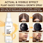 Hair Growth Spray, Natural Hair Growth Serum for Women With Rosemary Oil and Biotin Hair Oils, Prevent Hair Thinning & Anti-Hair Loss Treatment for Women & Men, Non-Greasy, 60ml Bottle