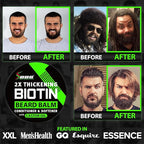 Biotin Beard Balm + XXL Beard Growth Serum + 620,000mcg Beard Growth Vitamins – Beard Growth Kit for Men with Mustache Wax, Collagen, MSM & Castor Oil – Fills Patches, Thickens & Styles