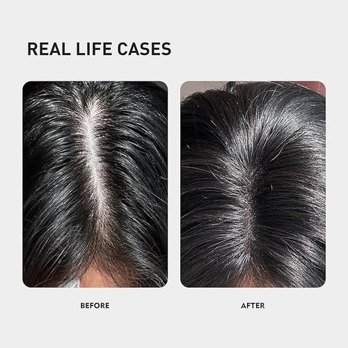 0.9% KX-826 KINTOR Hair Growth Spray,Strengthen Hair Nourish Hair follicles,Hair Care Products for Sparse Hair and Oily Hair Men&Women,180ml,Pro