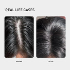 0.9% KX-826 KINTOR Hair Growth Spray,Strengthen Hair Nourish Hair follicles,Hair Care Products for Sparse Hair and Oily Hair Men&Women,300ml,Pro