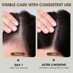 PP405 Hair Treatment – Lightweight Scalp Serum for Fuller-Looking Hair, Non-Greasy Formula with Hyaluronic Acid & Biotin, For Men & Women