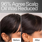 Act+Acre Cold Processed 4% Niacinamide Oily Scalp Serum | Reduces Oil & Odor | Fermented Green Tea + Astragalus | Extends Time Between Washes | Vegan, Fragrance-Free | 2.2 Fl Oz