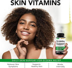 Greenford Eczema Treatment & Support for Natural Relief - Made in USA - Skin Vitamins & Herbals for Eczema, Acne, Psoriasis, Rosacea Treatment with Zinc, Niacinamide & Probiotics - 60 caps