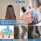 URTHEONE Hair Scalp Massager Shampoo Brush,Soft Silicone Hair Brush for Wet Dry Oily Curly Straight Thick Thin Rough Long Short Natural Men Women Kids Pets Hair Care Tools(Sky Blue)