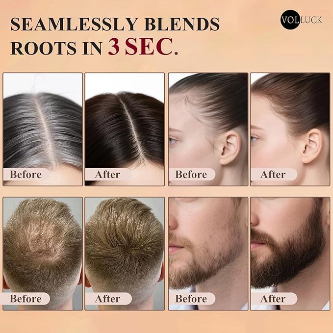 VOLLUCK Hairline Powder Instantly, Root Touch up Powder Hair Color Upgraded, Grey Root Cover up Conceals Hair Loss, Hairline Shadow for Women & Men for Thinning Hair Natural, Sweatproof (Light Brown)